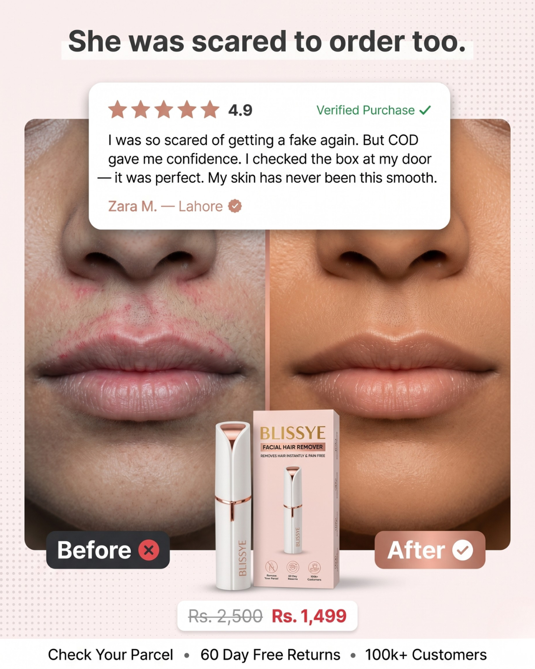 Blissye- Facial Hair Remover