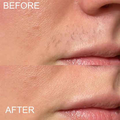 Blissye Hair Remover