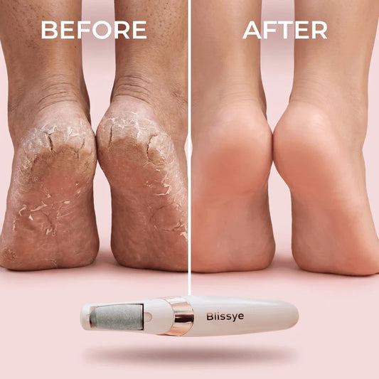 BLISSYE CALLUS REMOVER