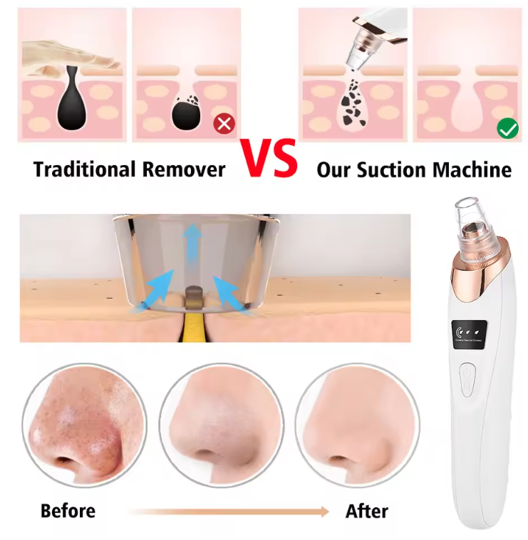 Blissye Premium Black Head Suction Machine
