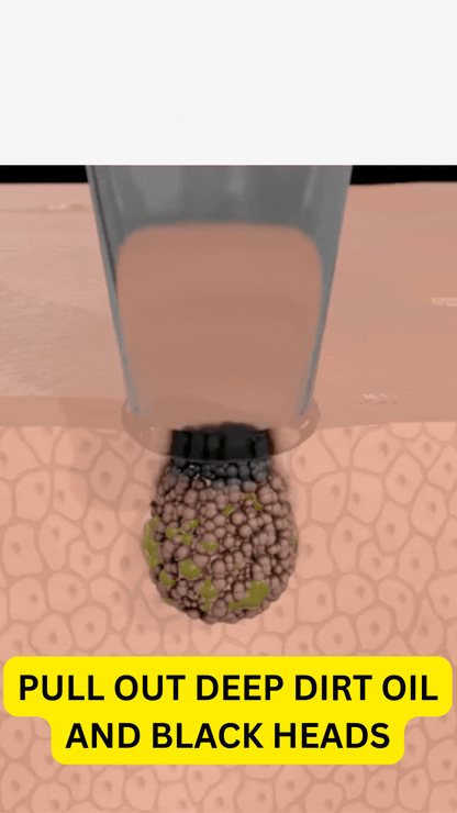 Blissye Premium Black Head Suction Machine