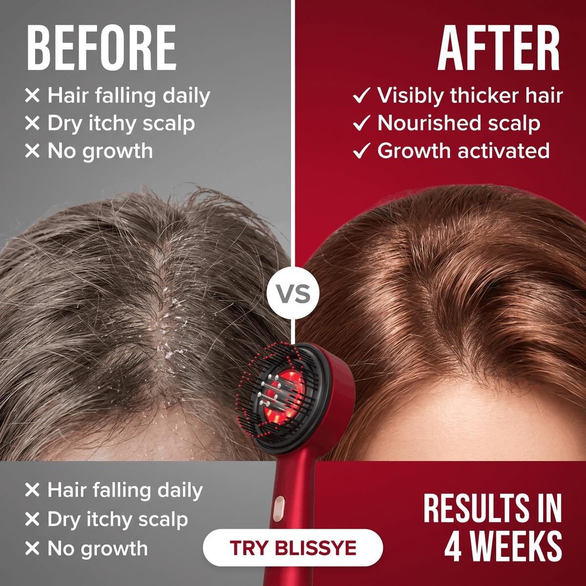 Blissye 3 in 1-Red Light Therpy Scalp Comb