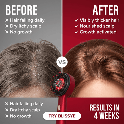 Blissye Root Reviver, Comb (Red Light Therapy)